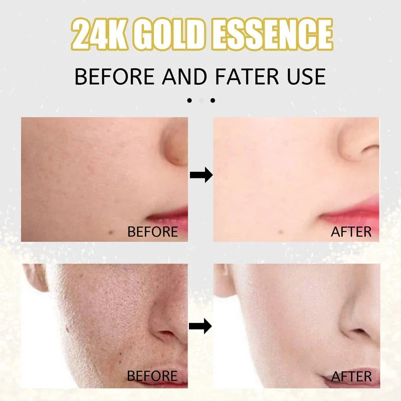 Gold moisturizing serum [anti-wrinkle and anti-aging]