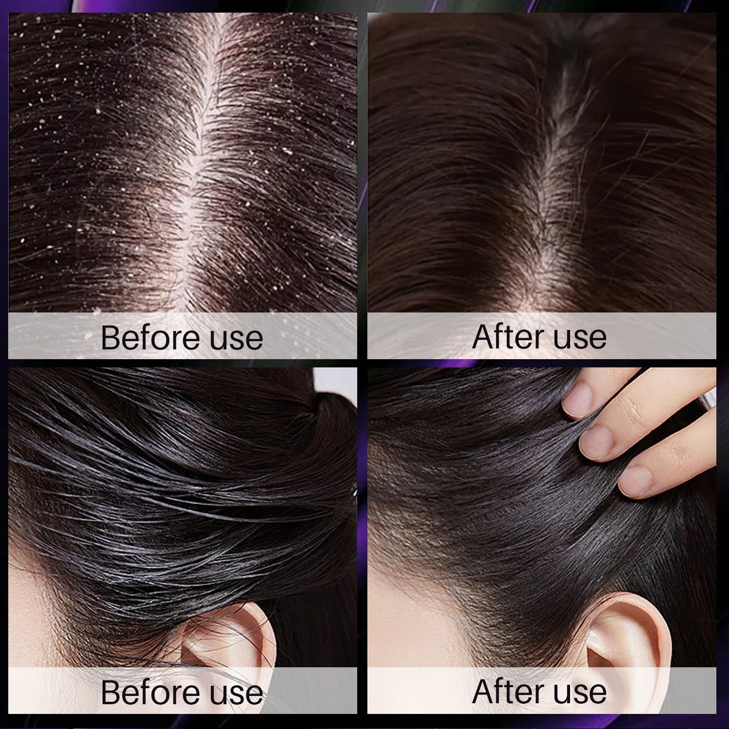 Shampoo for rapid growth [effective in 7 days]